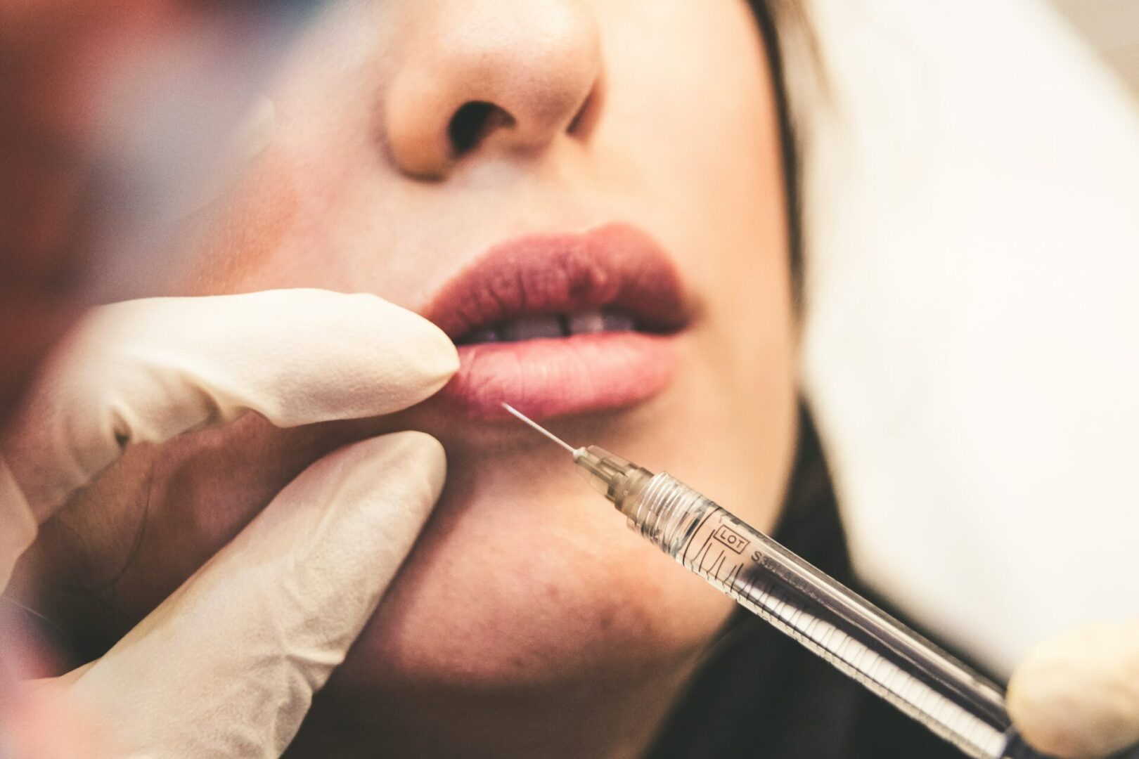 Lip injection cosmetic procedure.